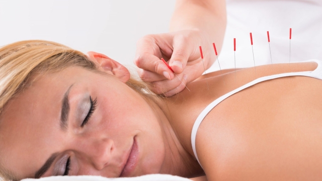 Needles of Serenity: The Transformative Power of Acupuncture